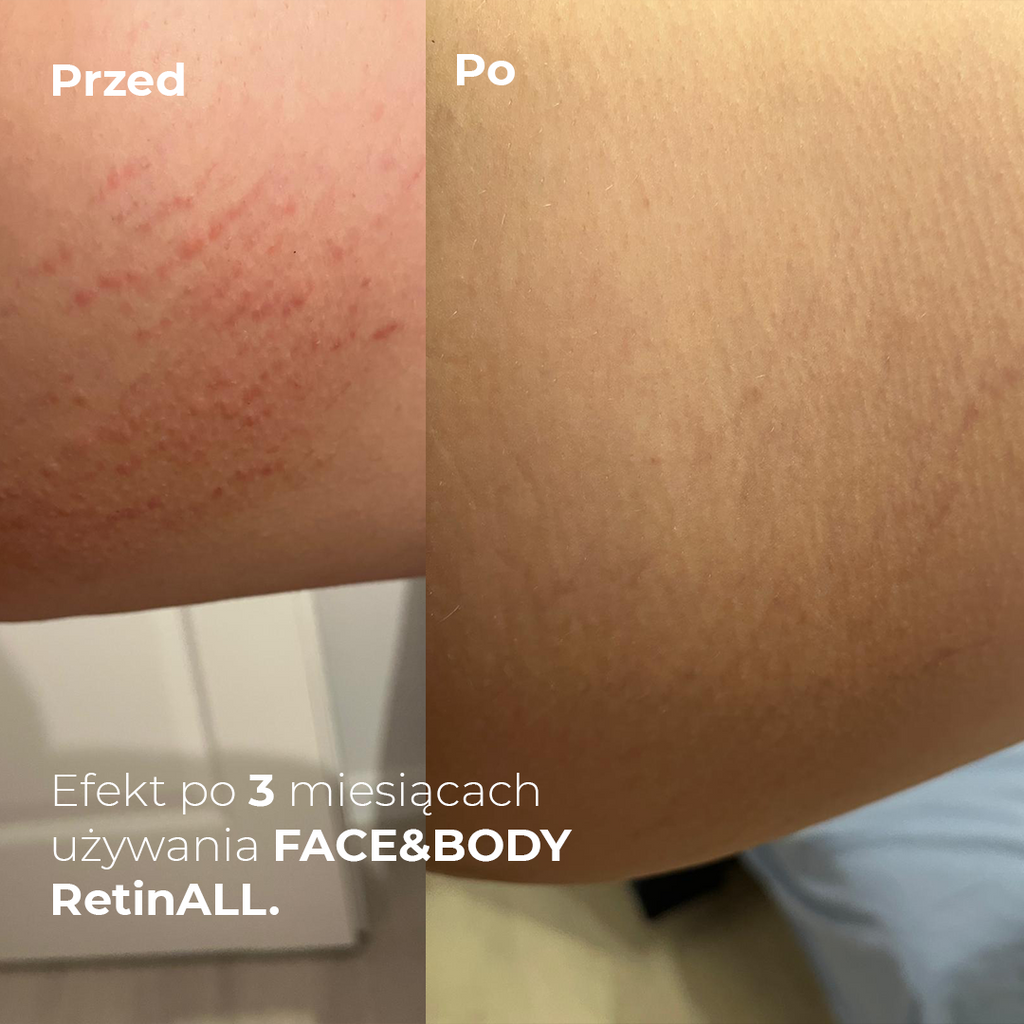 FACE & BODY RetinALL Krem ze stabilną formą retinalu 0,05% (7966533484781)